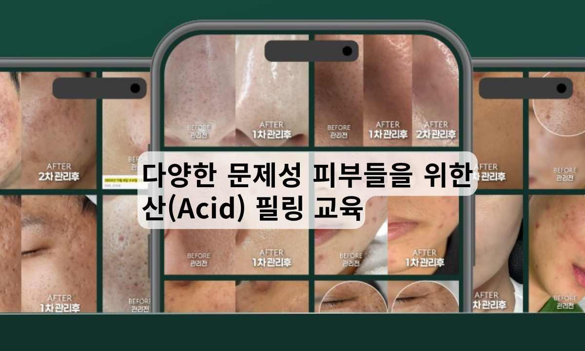 [4/22,수][제휴세미나/광주광역시] 산필링을 이용한 문제성 피부 케어 ㅣ 바이오리필 세미나